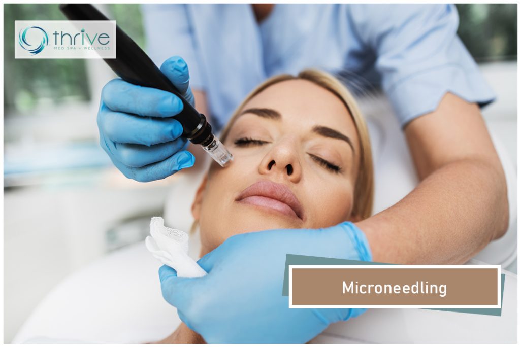 Microneedling Portsmouth NH