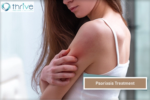 Psoriasis Treatment with a Laser Portsmouth NH